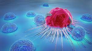 "ابتكار مهم" يمنع انتشار السرطان و"ينهي" عذاب العلاج الكيميائي